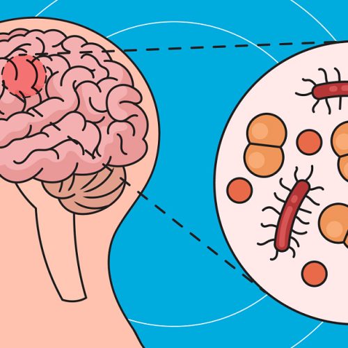 Менингококк – от насморка до госпитализации в один момент